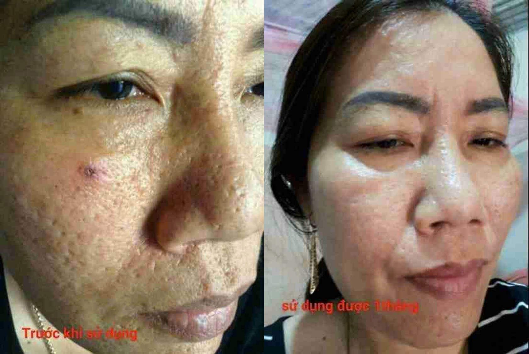 Hai ảnh khuôn mặt khác do người dùng chia sẻ